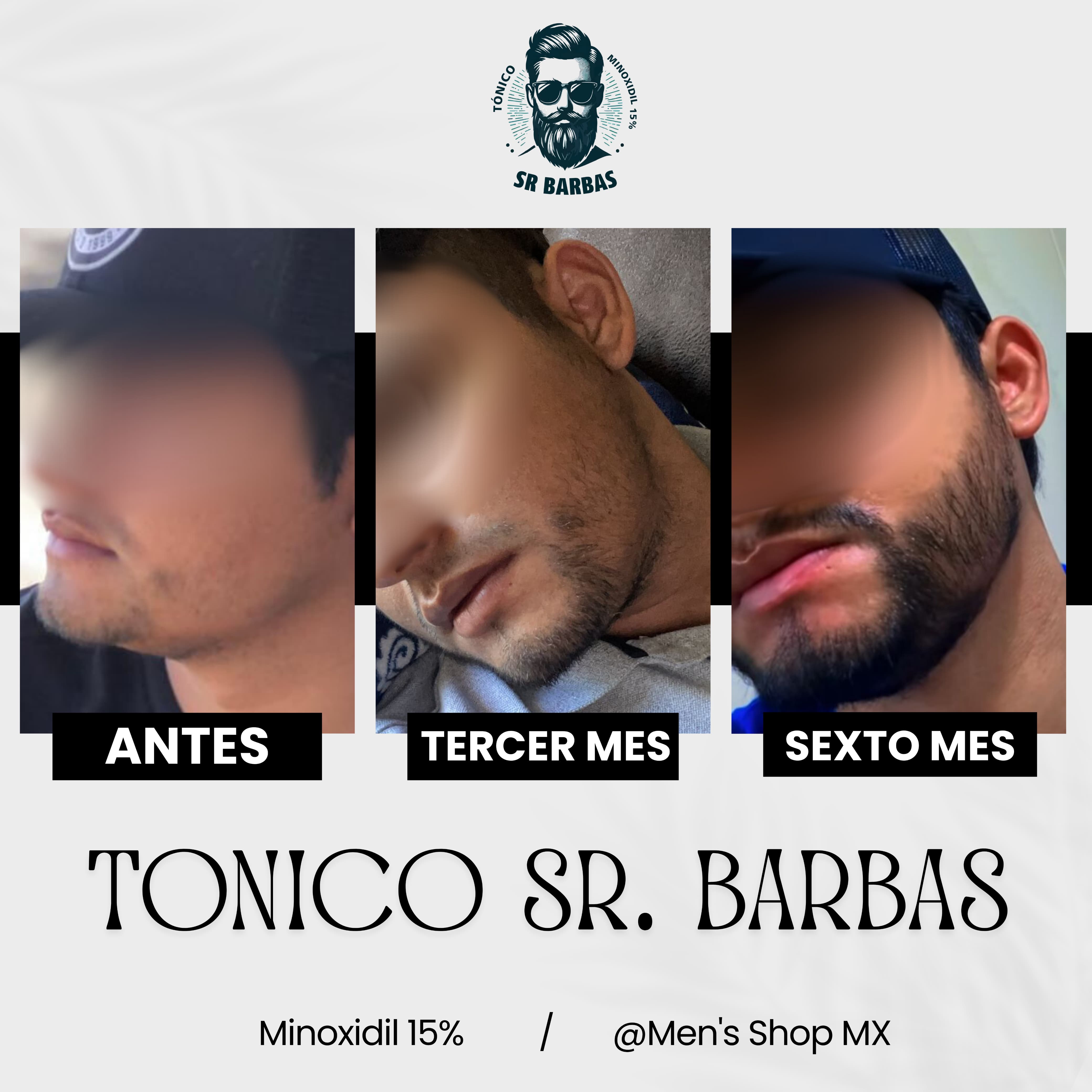 Tónicos SR BARBA